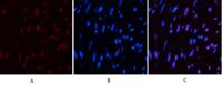 CD10 Monoclonal Antibody(5B8)