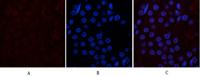 CD10 Monoclonal Antibody(5B8)