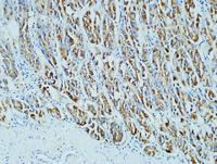 CD15 Monoclonal Antibody(Q89)