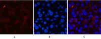 CD21 Monoclonal Antibody(2C5)