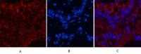 CD4 Monoclonal Antibody(11A1)