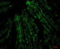 CD4 Monoclonal Antibody(11A1)