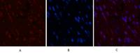 CD5 Monoclonal Antibody(10G8)