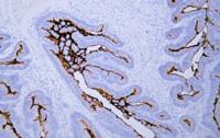 carcinoembryonic antigen (ABT-CEA) mouse mAb