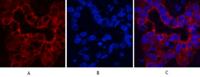 CK16 Monoclonal Antibody(6F6)