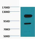 Cleaved PARP Monoclonal Antibody(Mix)