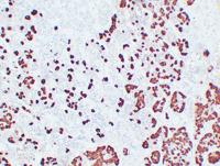 Adrenocorticotropin(ACTH) (ABT-ACTH) mouse mAb