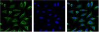 Aquaporin 4 Monoclonal Antibody(4H1)