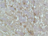 GAP-43 Monoclonal Antibody(Mix)