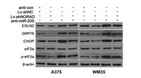 CHOP mouse Monoclonal Antibody(2B1)