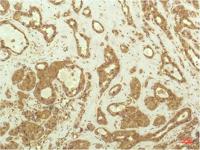 P70 S6 Kinase mouse Monoclonal Antibody(1C7)