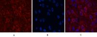 AMACR Monoclonal Antibody(4A12)