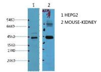 AMACR Monoclonal Antibody(4A12)