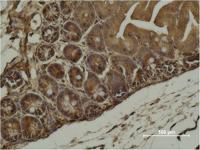 α-SMA Monoclonal Antibody(1E12)