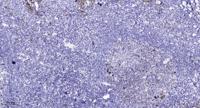 VE-Cadherin mouse Monoclonal Antibody(3G8)