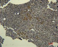 Transferrin Monoclonal Antibody(10G3)