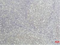 TNF-α Monoclonal Antibody(Q34)