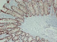 TGF β Receptor I (ABT-TGFR1) mouse mAb