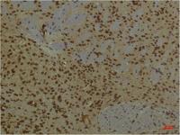 PI 3 Kinase P85α Monoclonal Antibody(3B7)