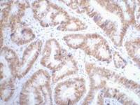 p53 Monoclonal Antibody(6C4)