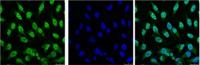 p53 Monoclonal Antibody(6C4)