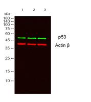 p53 Monoclonal Antibody(6C4)