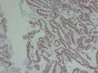 MutL Protein Homolog 1(MLH1) (ABT-MLH1) mouse mAb