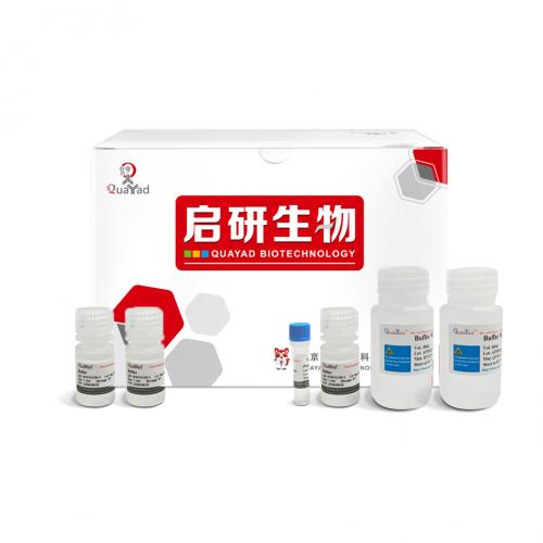 通用型总RNA提取试剂盒 Universal Total RNA Kit