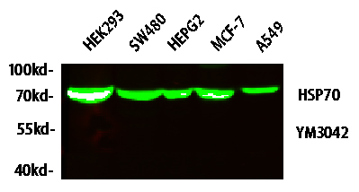 HSP70 Monoclonal Antibody(3G10)