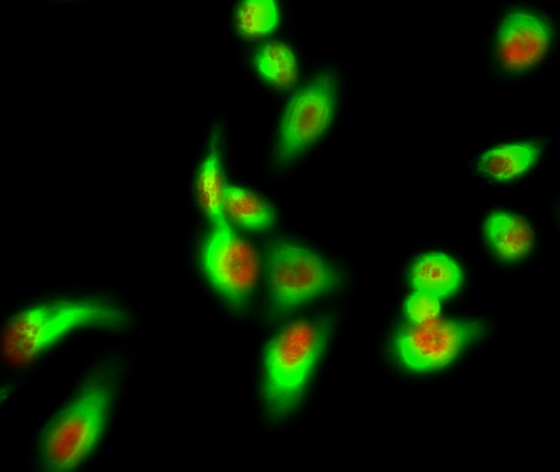 HSP70 Monoclonal Antibody(3G10)