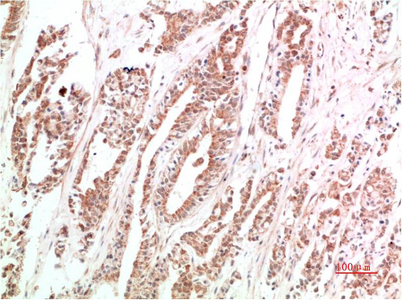 VEGF Rabbit Polyclonal Antibody