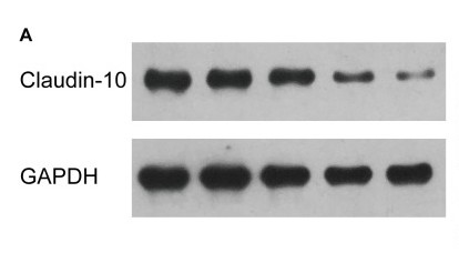 GAPDH Polyclonal Antibody