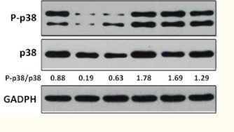 GAPDH Polyclonal Antibody