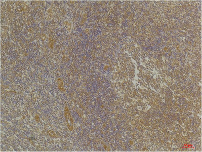 CXCR4 Polyclonal Antibody
