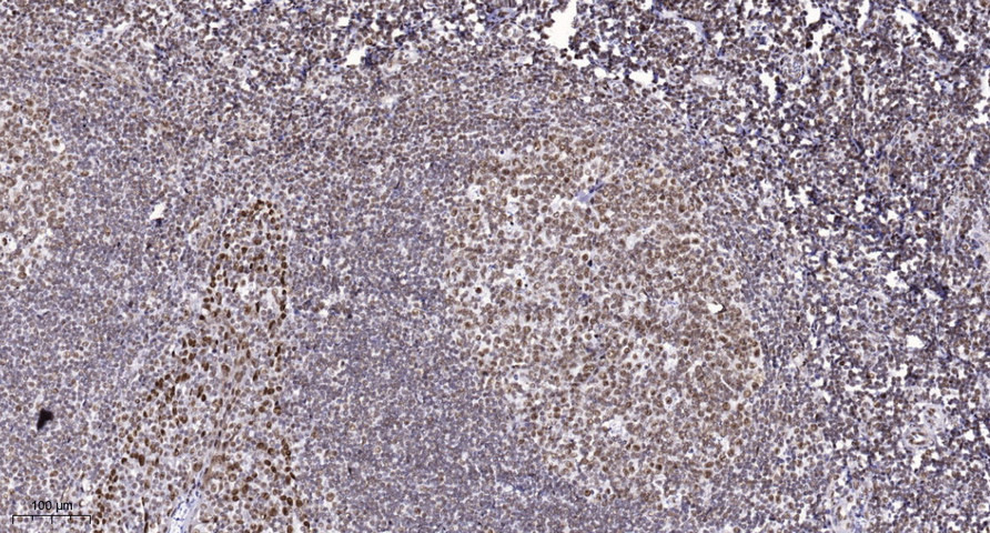 ALKBH5 Polyclonal Antibody