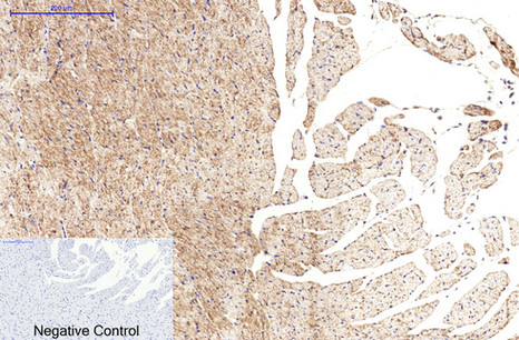 β-tubulin (HRP Conjugated) Monoclonal Antibody(5G3)