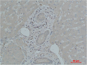 TF Polyclonal Antibody