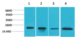 SOD1 Polyclonal Antibody