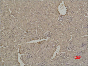 SOD1 Polyclonal Antibody