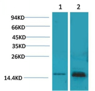 S100 Polyclonal Antibody