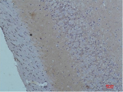 S100 Polyclonal Antibody