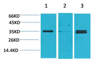 L-type Ca++ CP γ5 Polyclonal Antibody