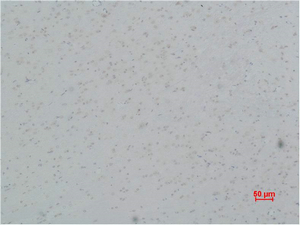 L-type Ca++ CP γ5 Polyclonal Antibody
