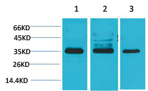 L-type Ca++ CP γ4 Polyclonal Antibody
