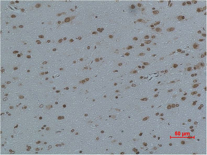 L-type Ca++ CP γ4 Polyclonal Antibody
