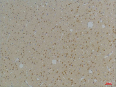 KVβ1 Polyclonal Antibody
