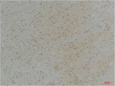 KVβ1 Polyclonal Antibody