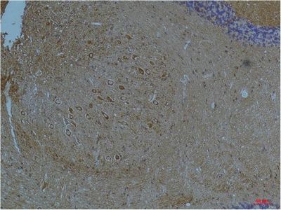 Kv11.3 Polyclonal Antibody