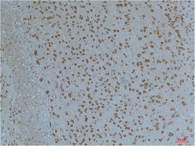 Kv11.1 Polyclonal Antibody