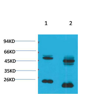Kv1.8 Polyclonal Antibody